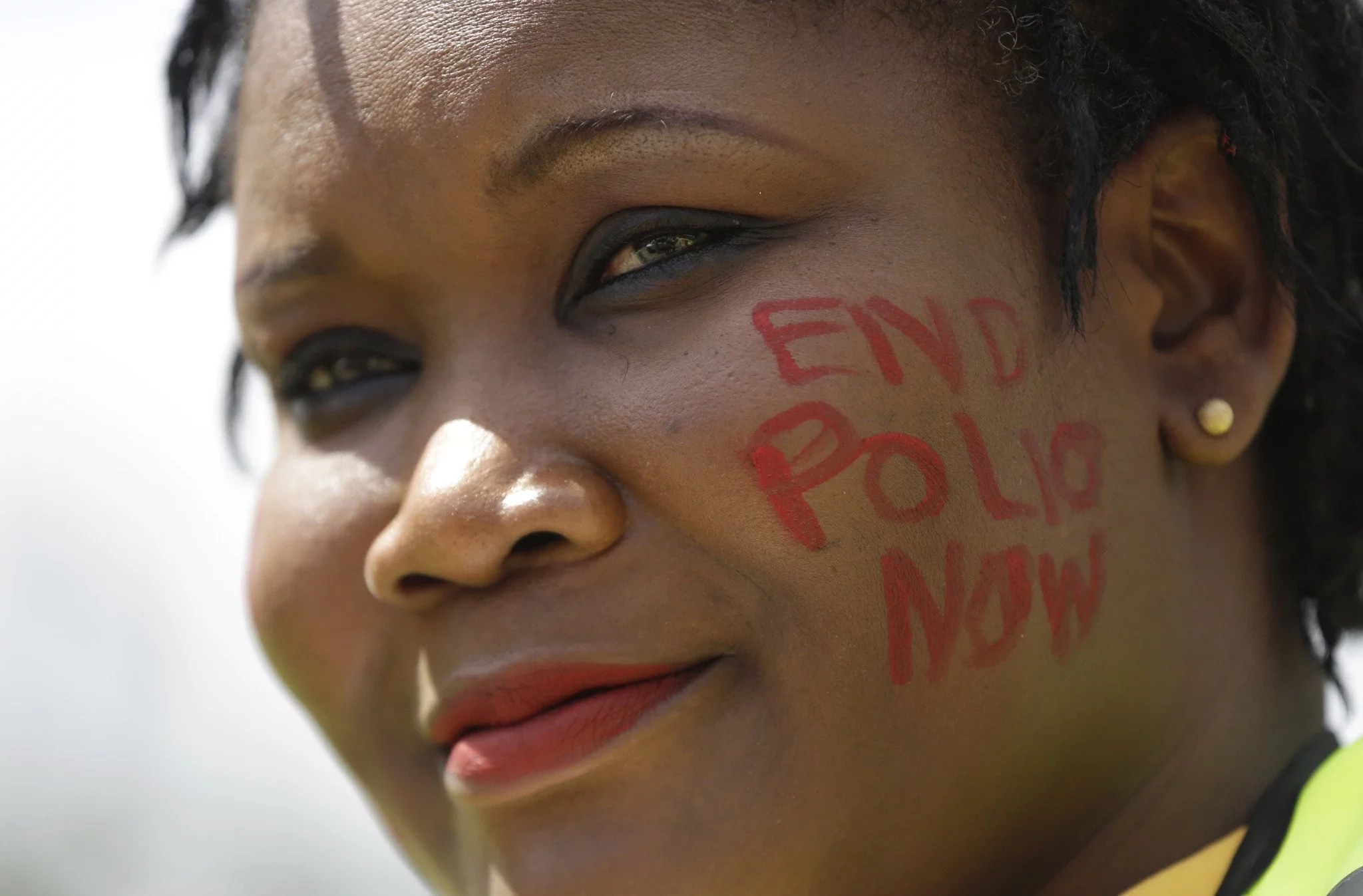 Africa-Libre-Polio2